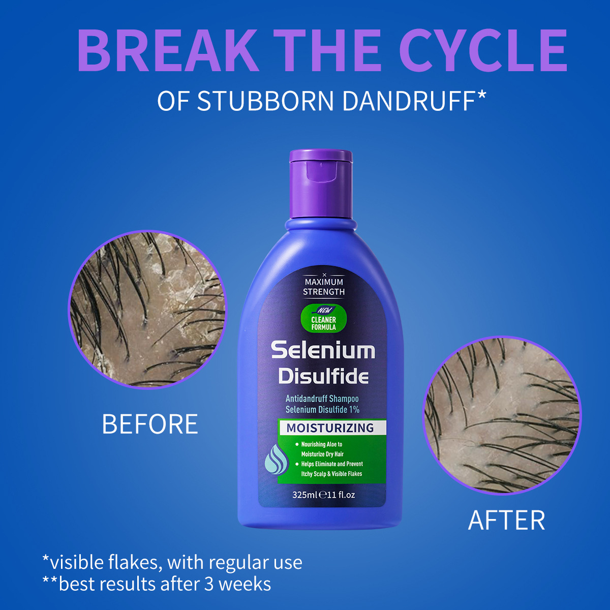 325ml Selenium Disulfide Anti  - đánh giá và giá Hair Care Dandruff